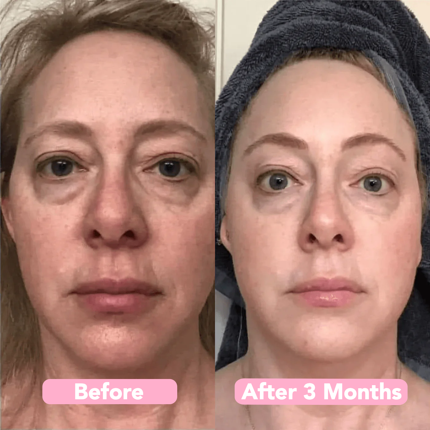 Instant Collagen Mask